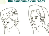 Филиппинский тест