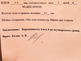 Хочу токсикоз) 10 ДЗ -ПЯ 5,5. Назначили утрожестан из за ЖТ,которое всего 17. У кого тоже так было?