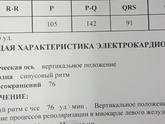 Спазм в области сердца
