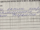 Фиброаденома