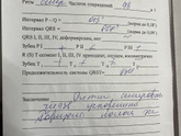 Кто разбирается в ЭКГ?)