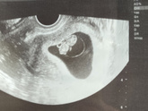 Вторая 🤰