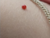 Девочки что это может