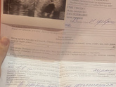 Девочки пожалуйста подскажите эндометрий