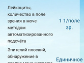Переслали мочу