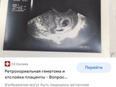 Не состоявшаяся двойня или что это?