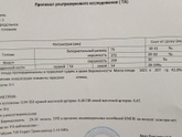 УЗИ на 30-й неделе