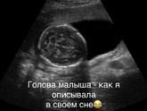 Сон на 10 дпо?