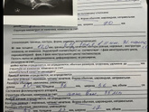 Девочки, поделитесь своими первыми