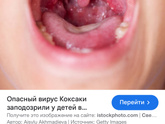 Это ветрянка ??