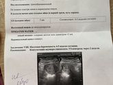 Узи