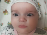 Синяки во внутренних уголках