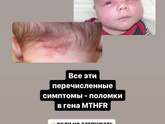 Вена на переносице
