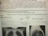 Пневмония