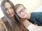 Косоглазие