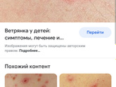 Как выглядит ветрянка?