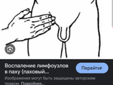 У ребёнка что то воспалмлось в паху на сгибе шарик, даже шевелить ногой больно не то чтоб идти.