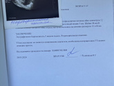 Сходила на узи… сначала