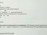 Узи. 6 нед. 3 дня.