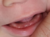 Интересно когда 😖🦷