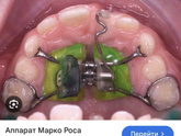 Марко роса