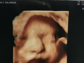 4D🥰😍