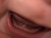 Зубы