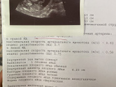 Наш первый скрининг)))