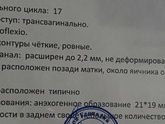 17дц