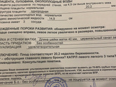 КАПРЛ -3 и обструкция главного левого бронха