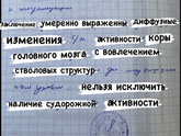 Расшифровка ЭЭГ