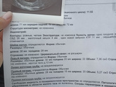 На учёт сказали приехать