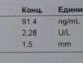 Очень срочно, кто сталкивался ‼️ синдром дауна