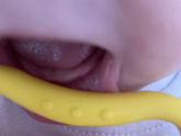 Зубы