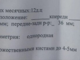 Шейка матки с многочисленными кистами