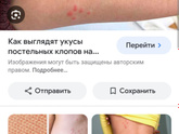 Срочно. Странные укусы