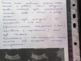 Результаты ГСГ