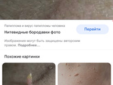 Папиллома пол языком
