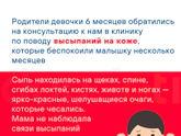 Атопический дерматит, помогите