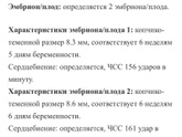Двойня 😱