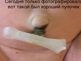 Пупок
