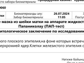 Анализ на онкоцитологию