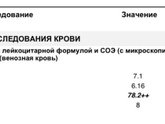 О чем это может говорить ?