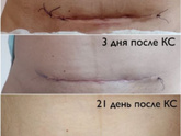 Ваше Состояние после КС