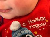 Аллергия?
