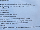 Аденоиды у ребенка