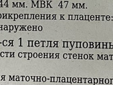 Девочки , у кого