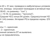 Холтер.