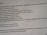Короче говоря, я в