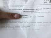 Фолликулометрия 18 дц